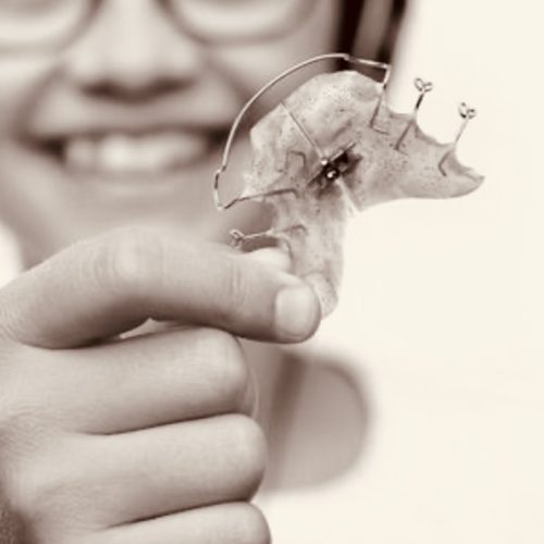orthodontie_fonctionnelle