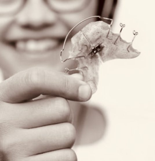 orthodontie_fonctionnelle